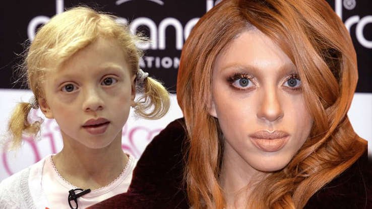 angela-ermakova-fruher